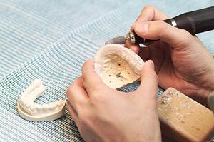 富山市にあるインプラントができる歯科