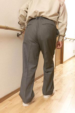 消えない蒙古斑はレーザーで治療